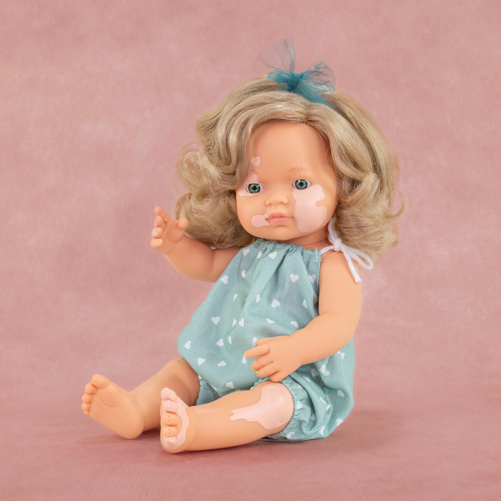 Girl with Vitiligo Dressed Baby Doll - 38cm