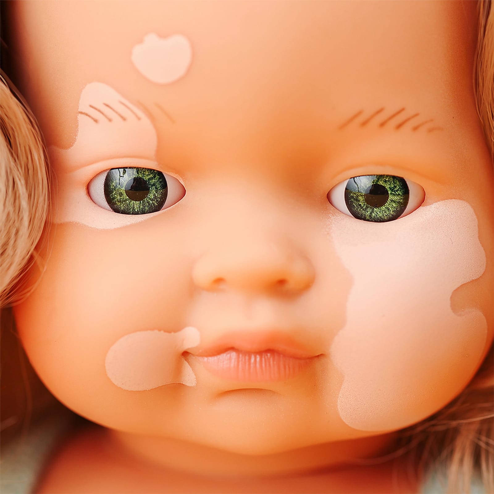 Girl with Vitiligo Dressed Baby Doll - 38cm